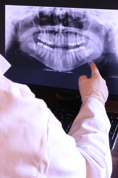Best Emergency Wisdom Tooth Extraction in Cherry Valley, IL