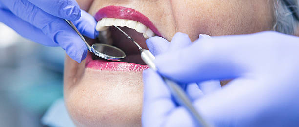 Best Emergency Denture Repair in Cherry Valley, IL